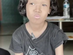 Ainun Bocah Usia 11 Tahun Warga Cilegon Mengidap Leukimia, Butuh Dukungan