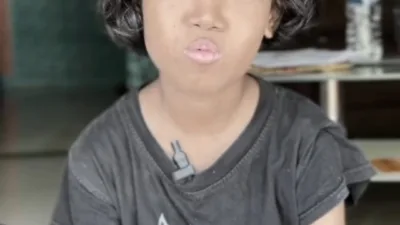 Ainun Bocah Usia 11 Tahun Warga Cilegon Mengidap Leukimia, Butuh Dukungan